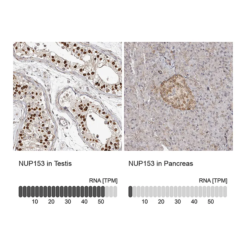 Atlas Antibodies Anti-NUP153 Antibody