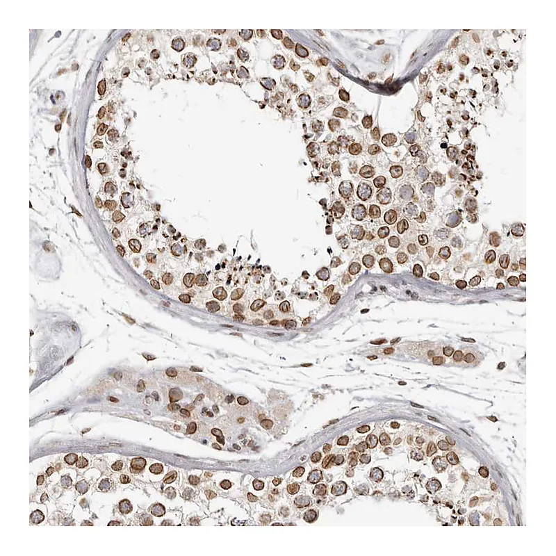 Atlas Antibodies Anti-NUP153 Antibody