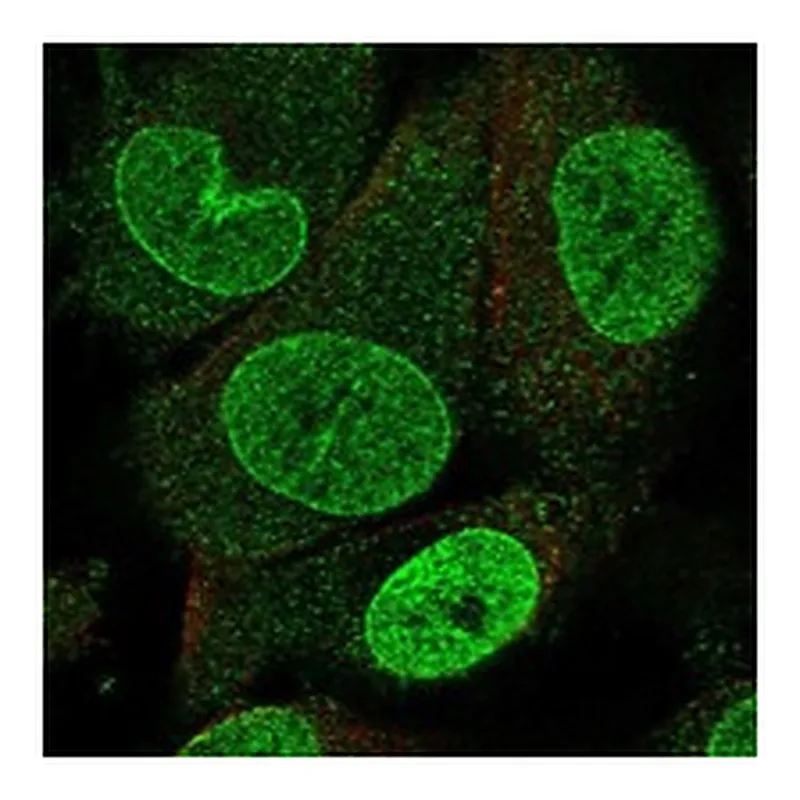 Atlas Antibodies Anti-NUP153 Antibody