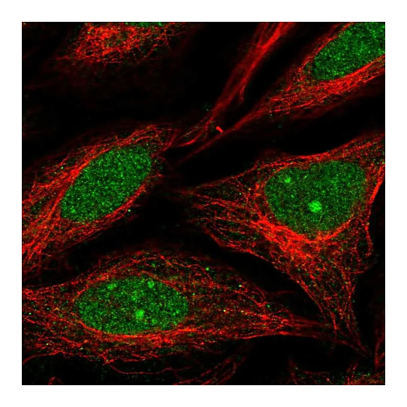 Atlas Antibodies Anti-NUP188 Antibody