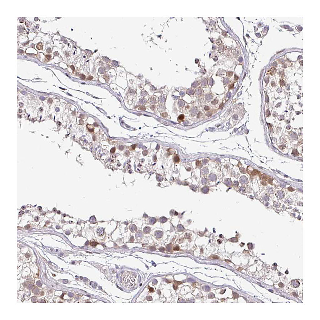 Atlas Antibodies Anti-NUP188 Antibody