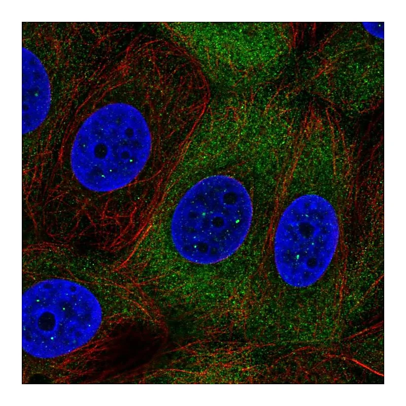 Atlas Antibodies Anti-NUP210L Antibody