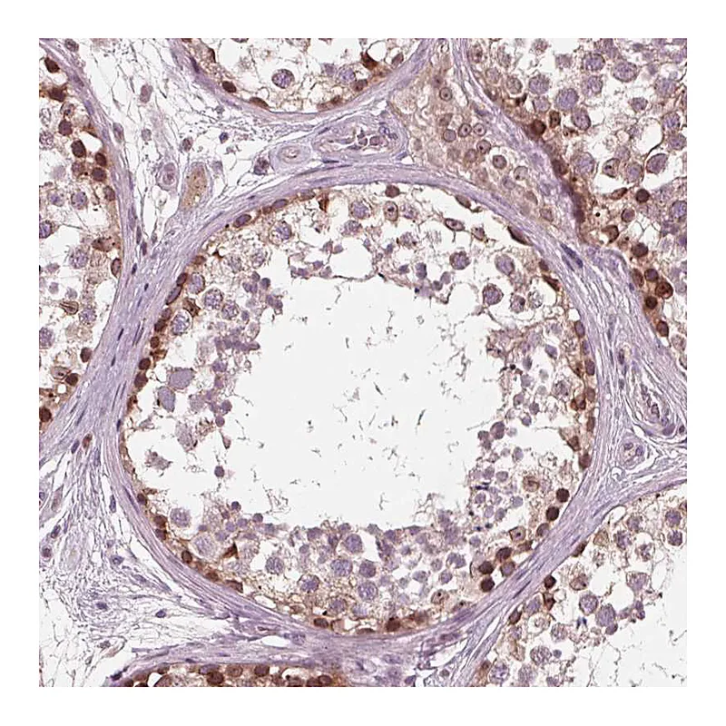 Atlas Antibodies Anti-NUP210 Antibody