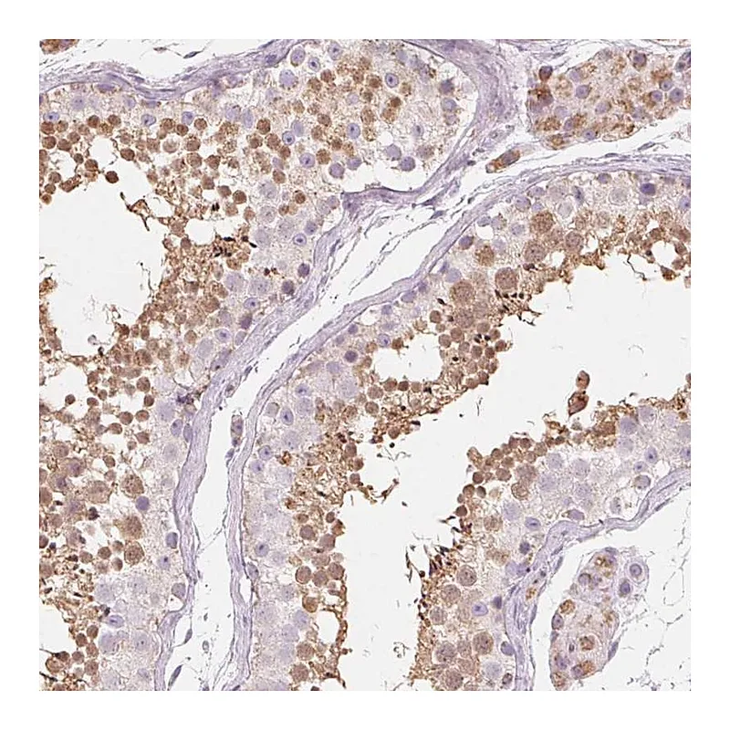 Atlas Antibodies Anti-NUP210L Antibody