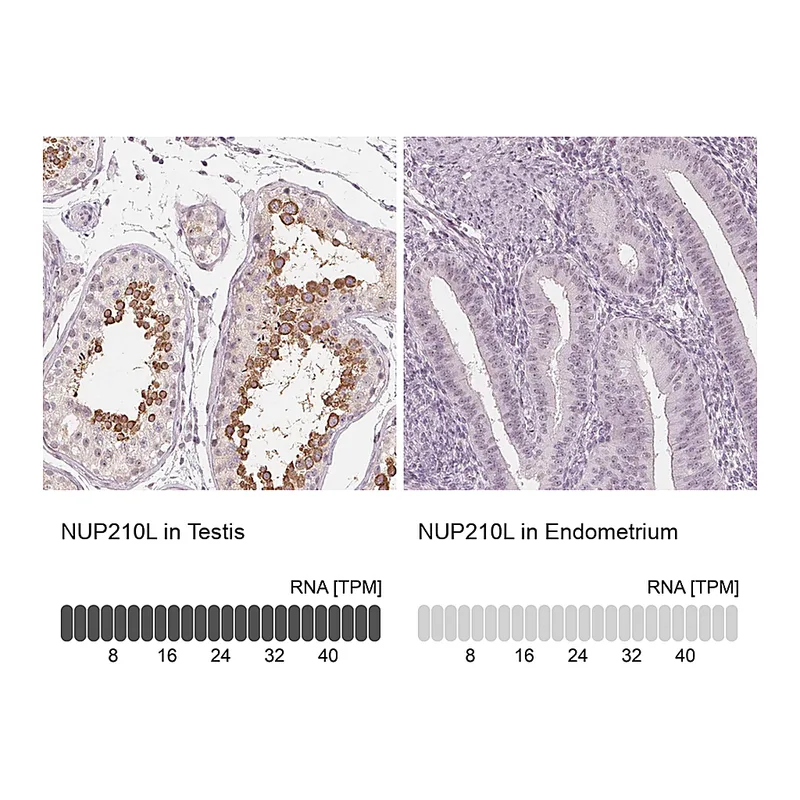 Atlas Antibodies Anti-NUP210L Antibody