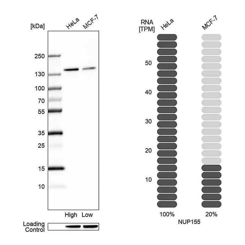 Atlas Antibodies Anti-NUP155 Antibody