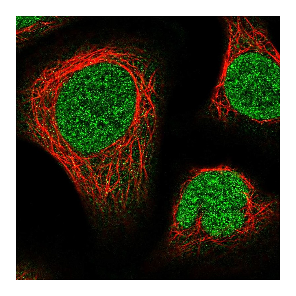Atlas Antibodies Anti-NUP214 Antibody