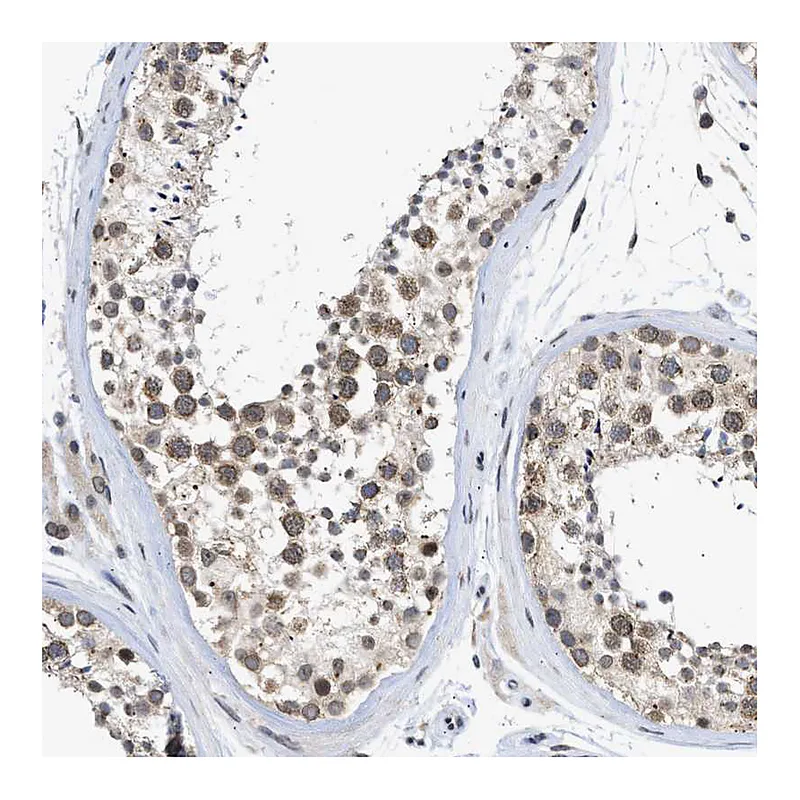 Atlas Antibodies Anti-NUP35 Antibody
