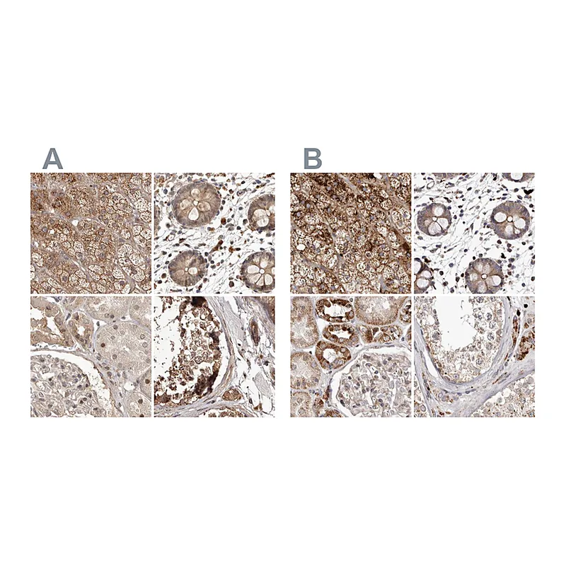 Atlas Antibodies Anti-NUP43 Antibody
