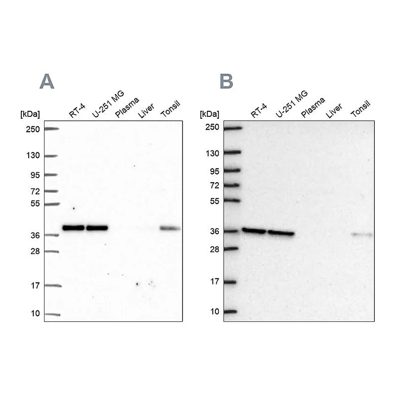 Atlas Antibodies Anti-NUP37 Antibody