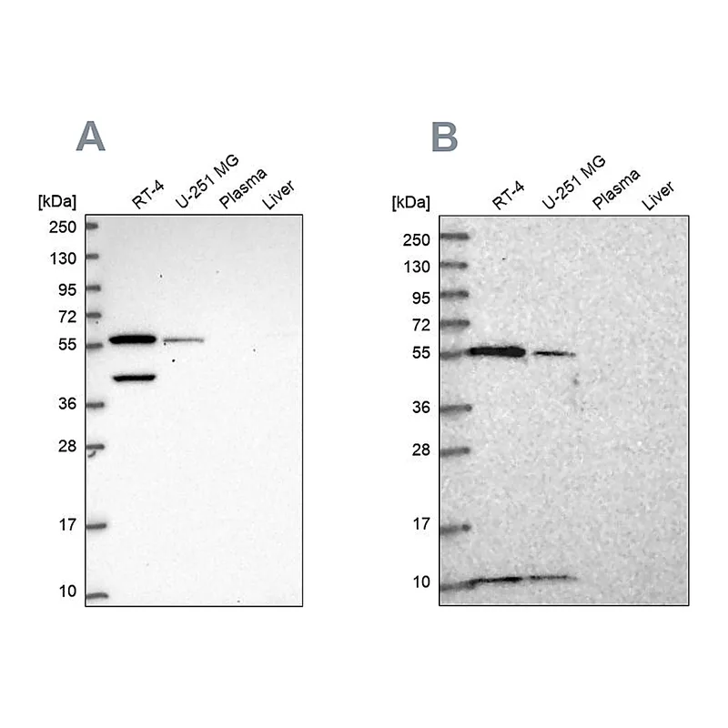 Atlas Antibodies Anti-NUP50 Antibody