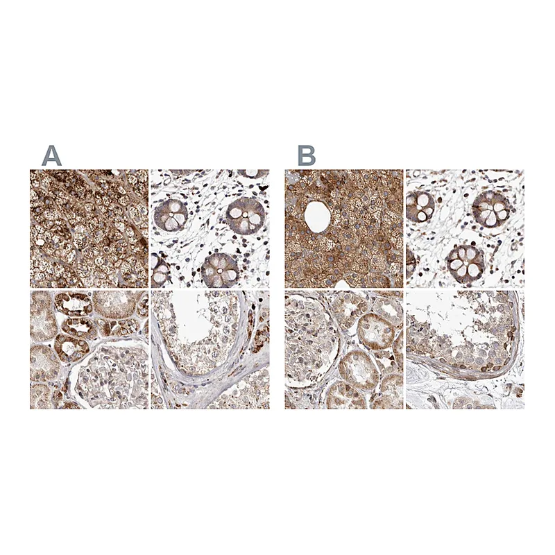 Atlas Antibodies Anti-NUP43 Antibody