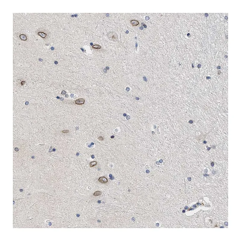 Atlas Antibodies Anti-NUP35 Antibody