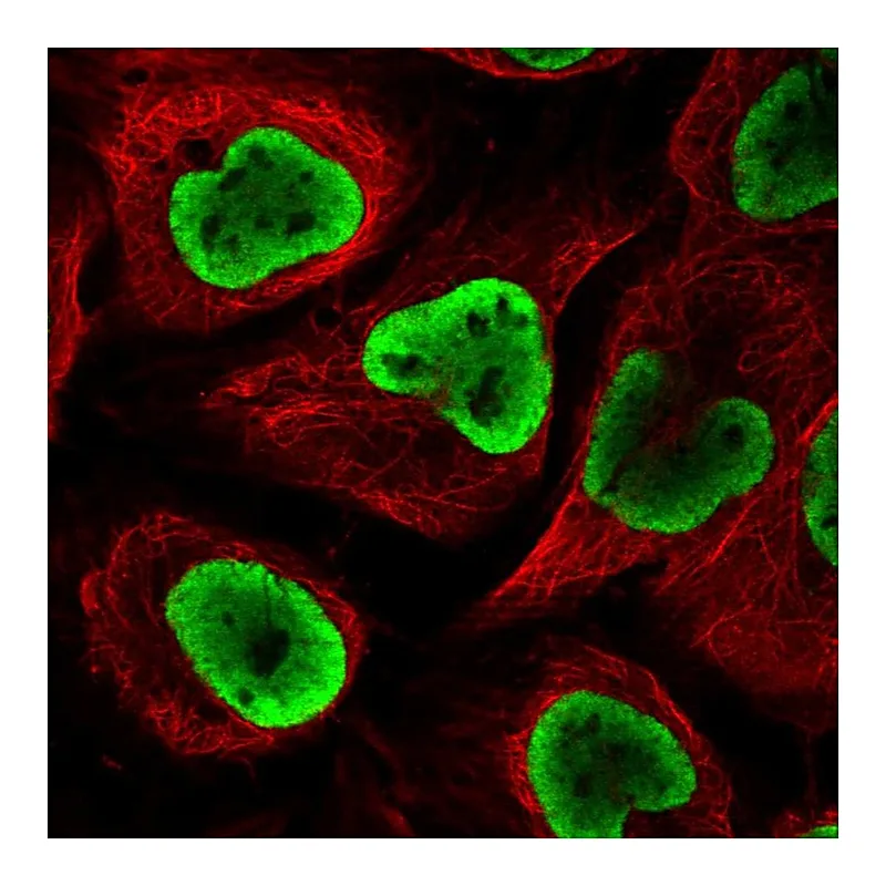 Atlas Antibodies Anti-NUP54 Antibody