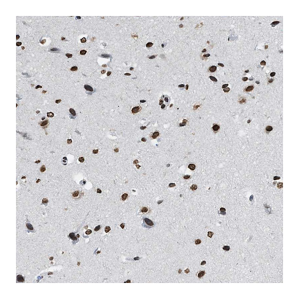 Atlas Antibodies Anti-NUP88 Antibody