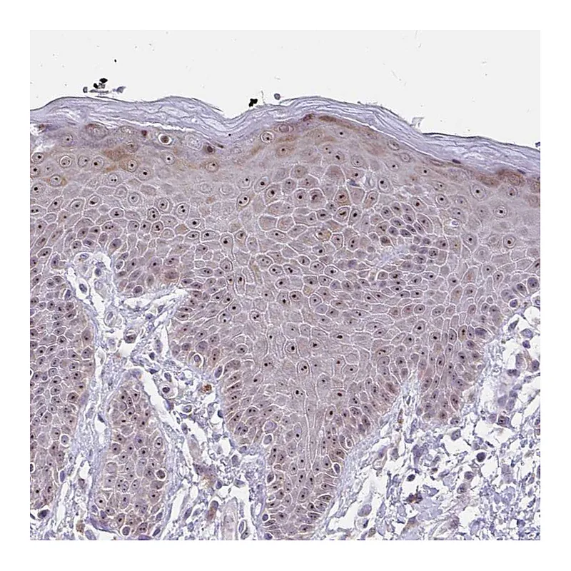 Atlas Antibodies Anti-NUP85 Antibody