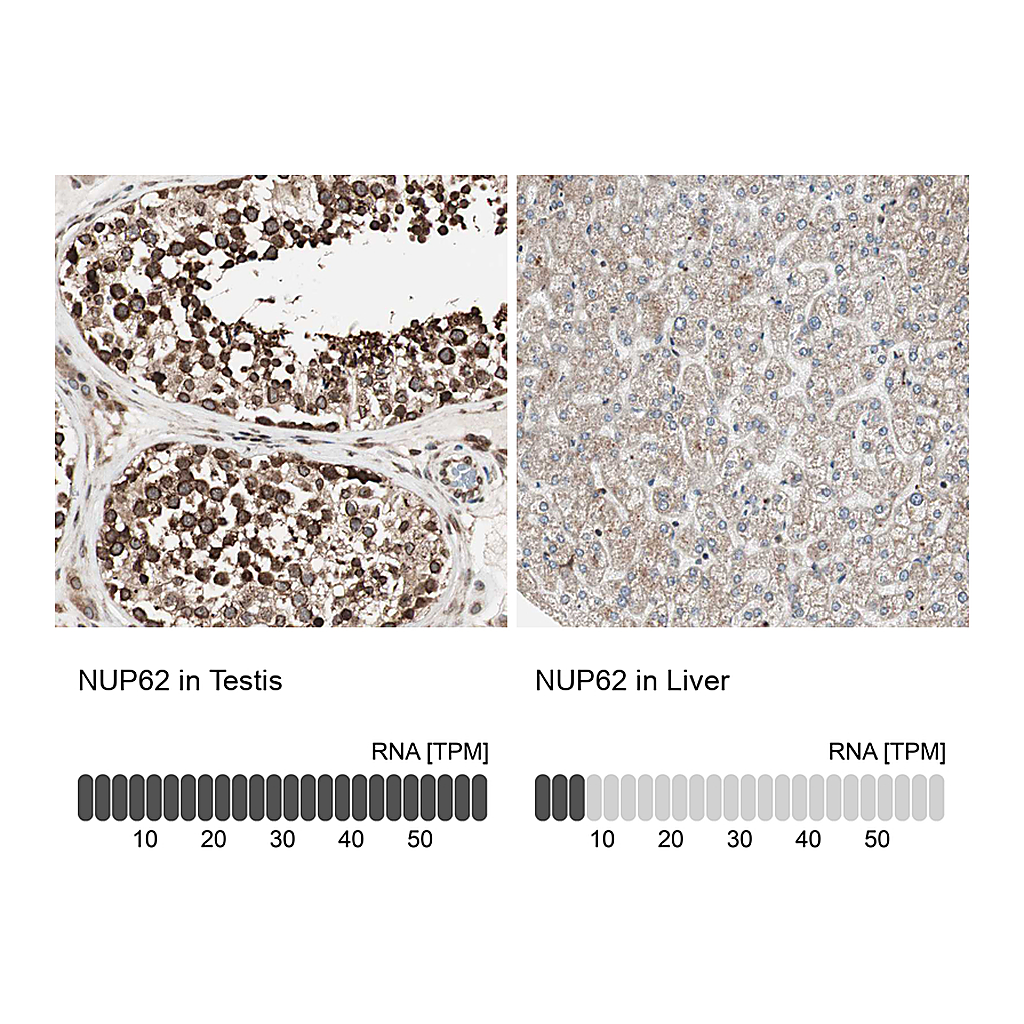 Atlas Antibodies Anti-NUP62 Antibody