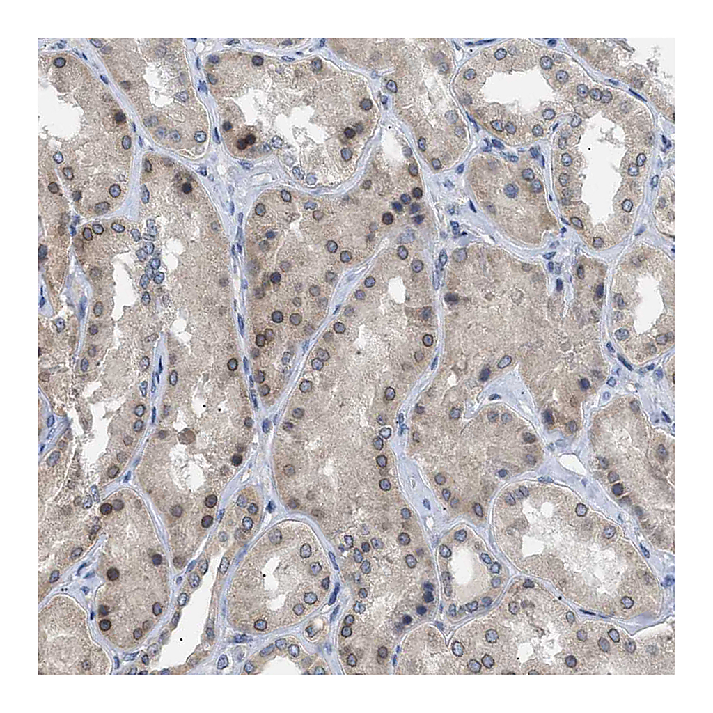 Atlas Antibodies Anti-NUP93 Antibody