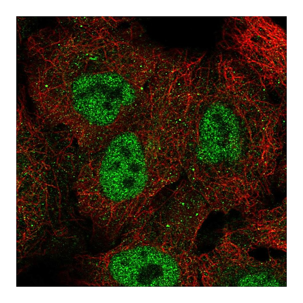 Atlas Antibodies Anti-NUP98 Antibody