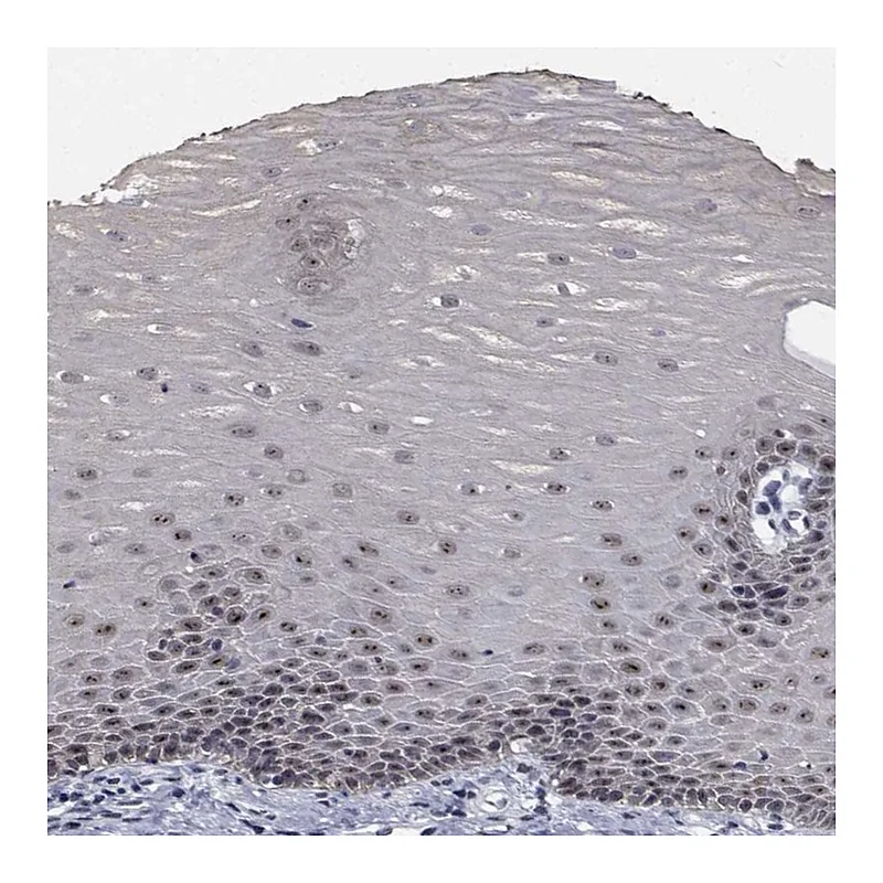 Atlas Antibodies Anti-NVL Antibody