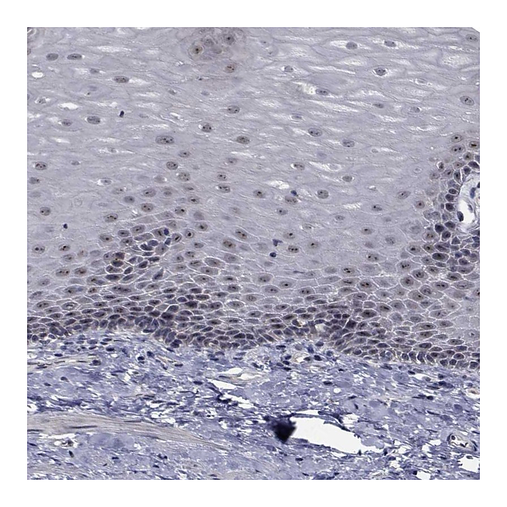 Atlas Antibodies Anti-NVL Antibody