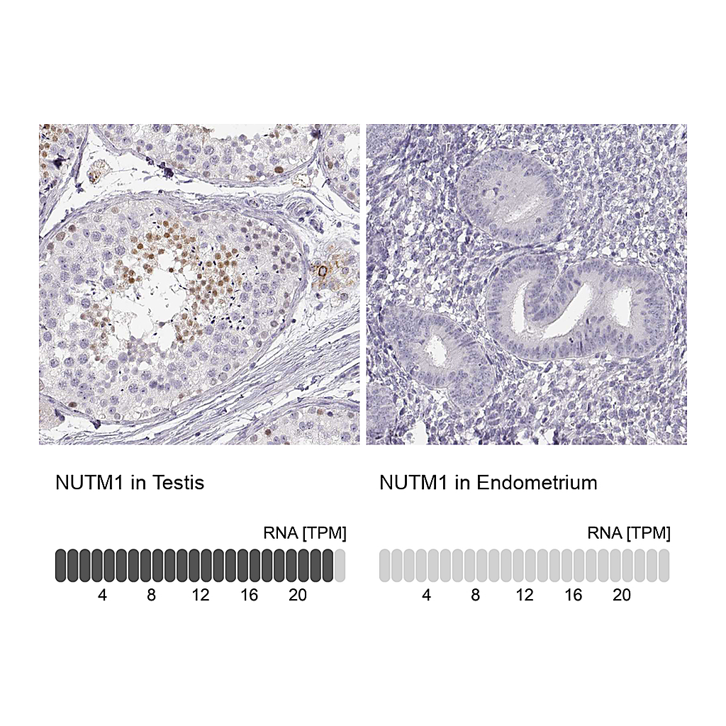 Atlas Antibodies Anti-NUTM1 Antibody
