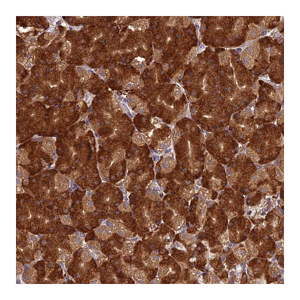 Atlas Antibodies Anti-NXNL2 Antibody