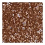 Atlas Antibodies Anti-NXNL2 Antibody