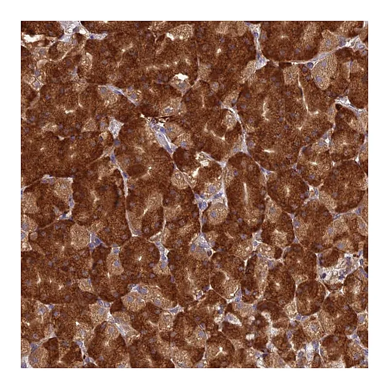 Atlas Antibodies Anti-NXNL2 Antibody