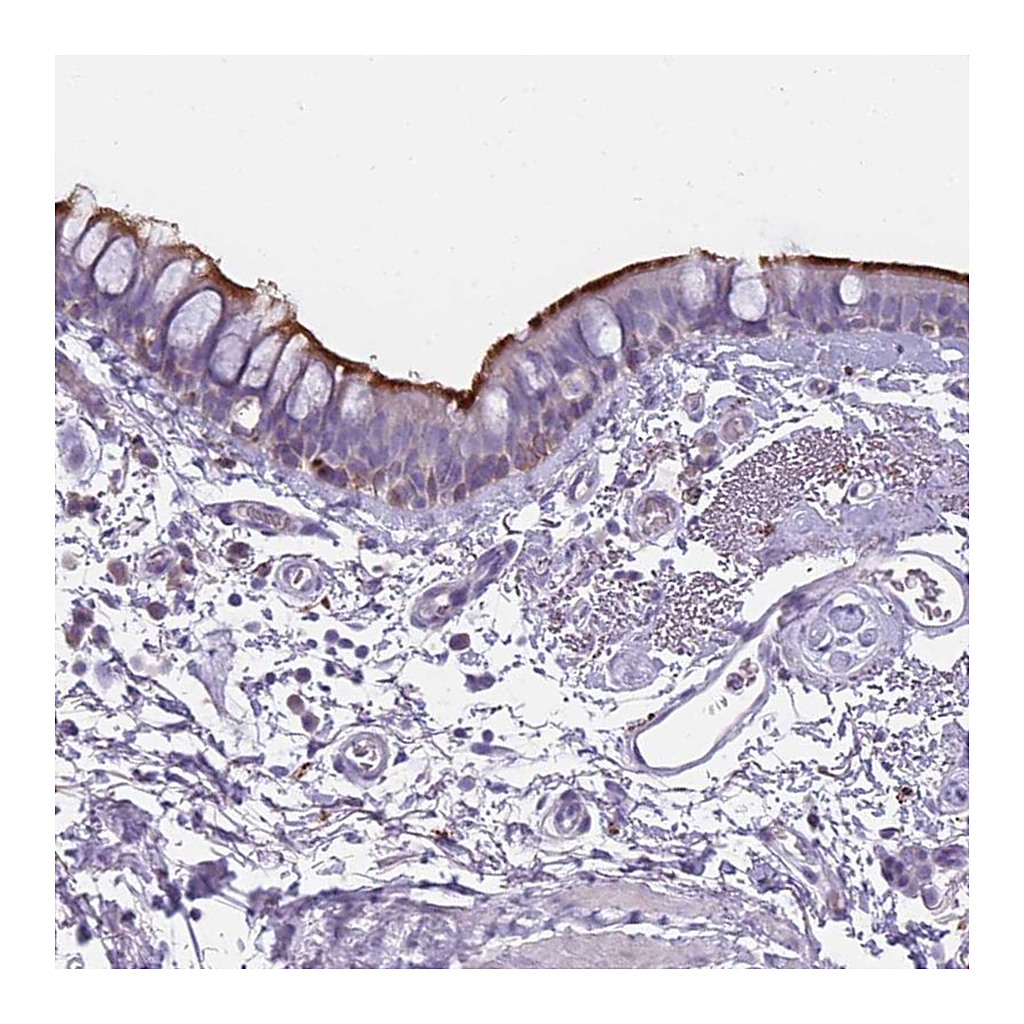 Atlas Antibodies Anti-NWD2 Antibody