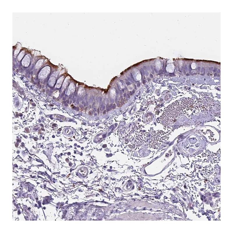 Atlas Antibodies Anti-NWD2 Antibody