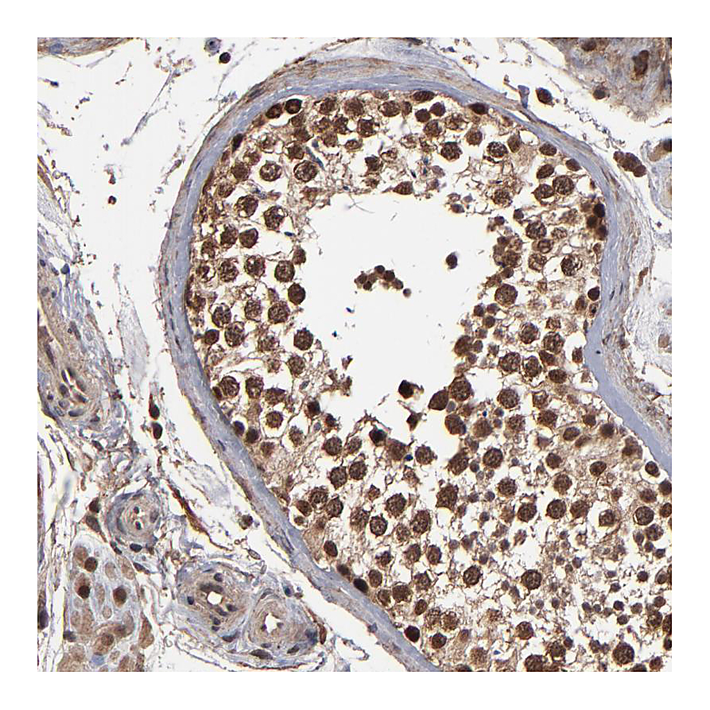 Atlas Antibodies Anti-NXF2B Antibody