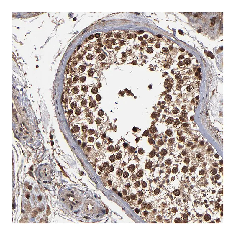 Atlas Antibodies Anti-NXF2B Antibody