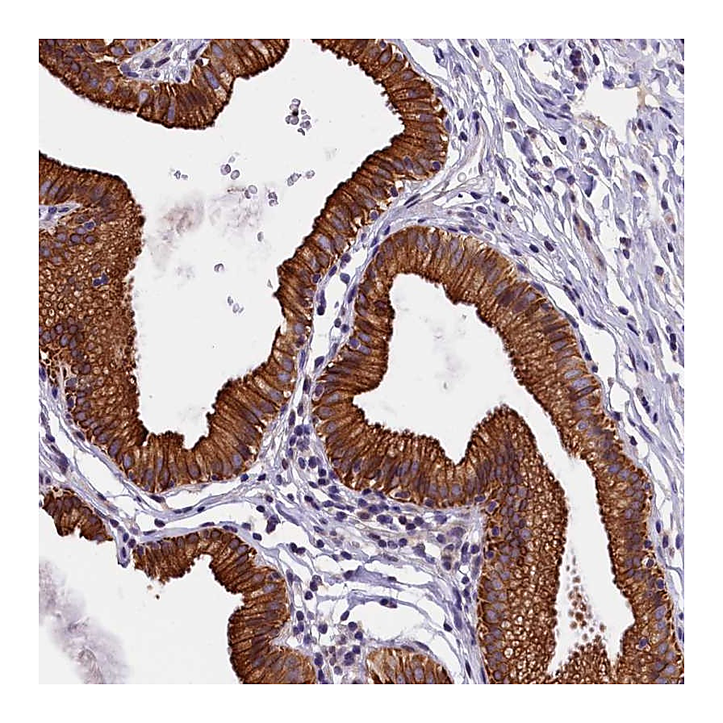 Atlas Antibodies Anti-NXNL1 Antibody