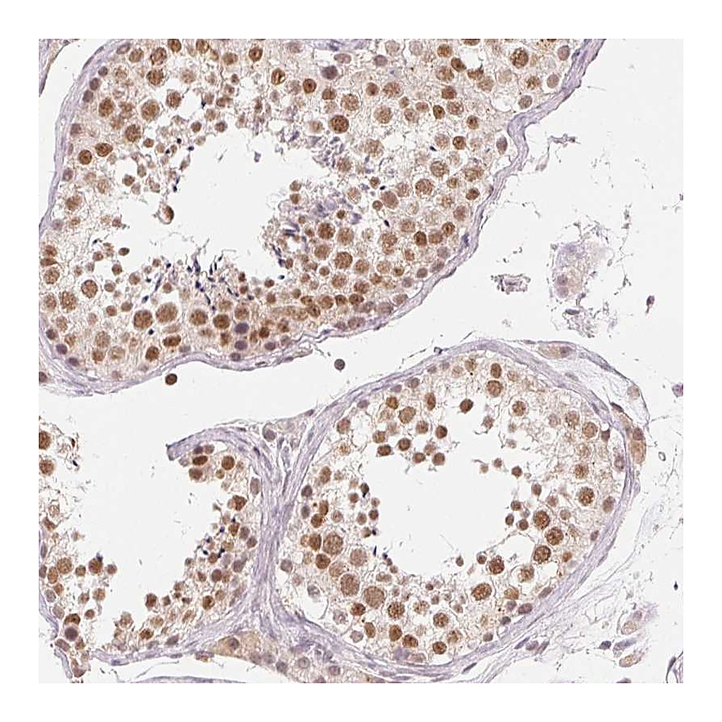 Atlas Antibodies Anti-NXF3 Antibody