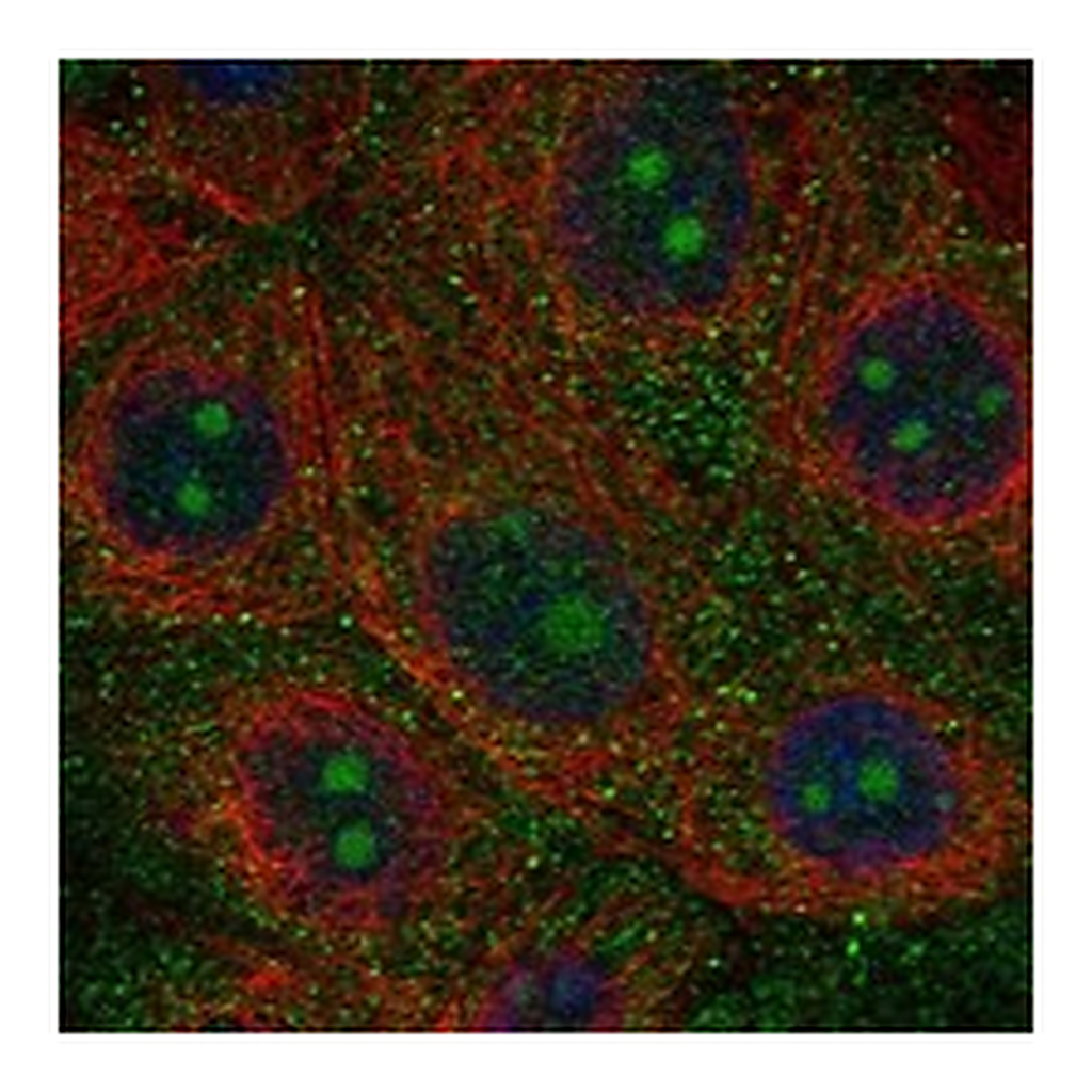Atlas Antibodies Anti-NWD1 Antibody