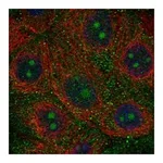 Atlas Antibodies Anti-NWD1 Antibody