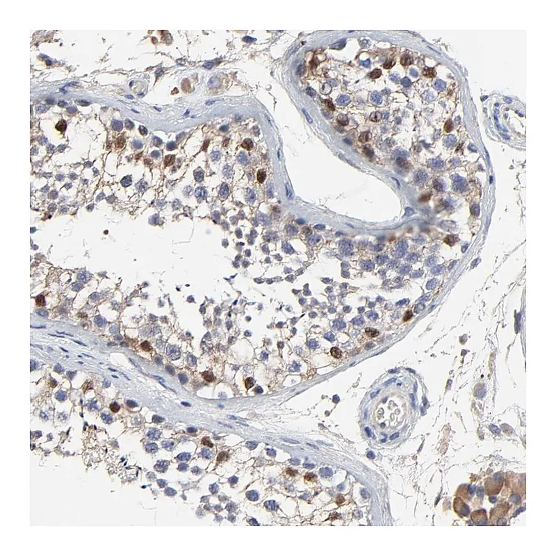 Atlas Antibodies Anti-NXF3 Antibody