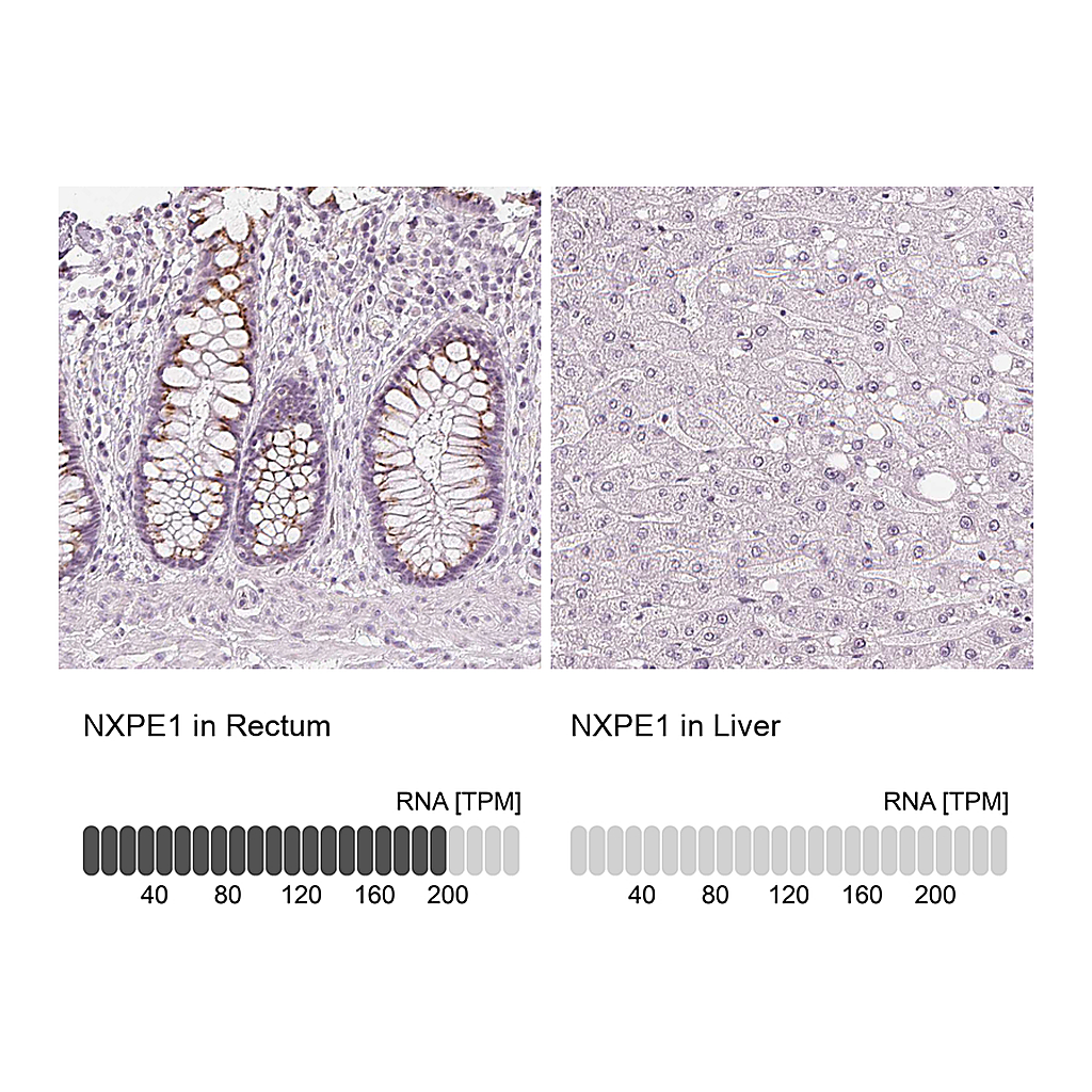 Atlas Antibodies Anti-NXPE1 Antibody