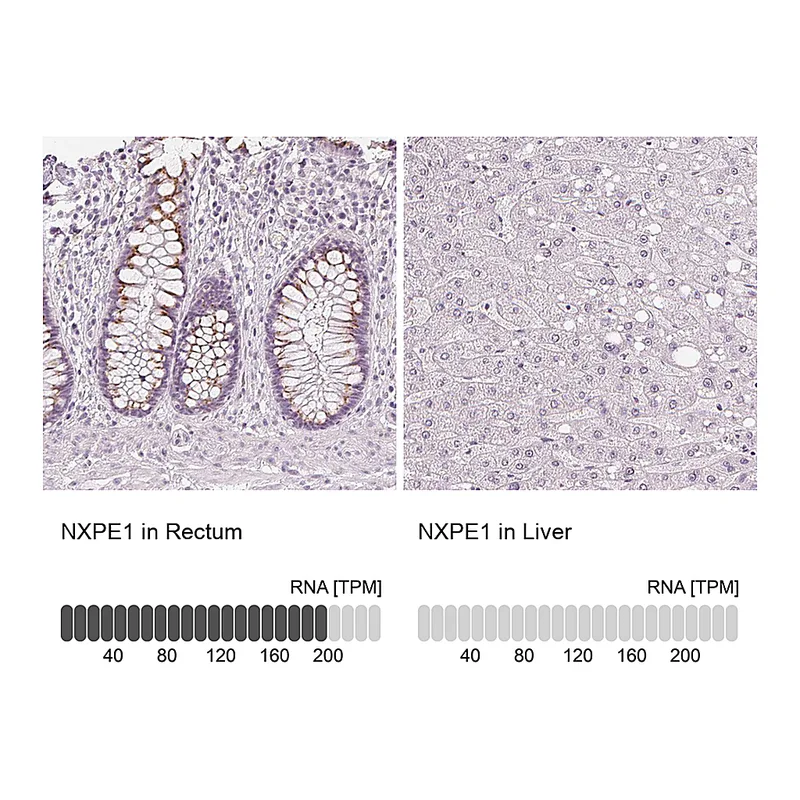 Atlas Antibodies Anti-NXPE1 Antibody