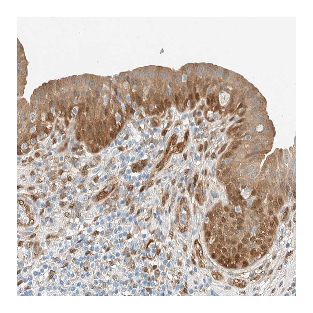 Atlas Antibodies Anti-NXN Antibody