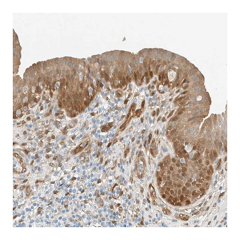 Atlas Antibodies Anti-NXN Antibody