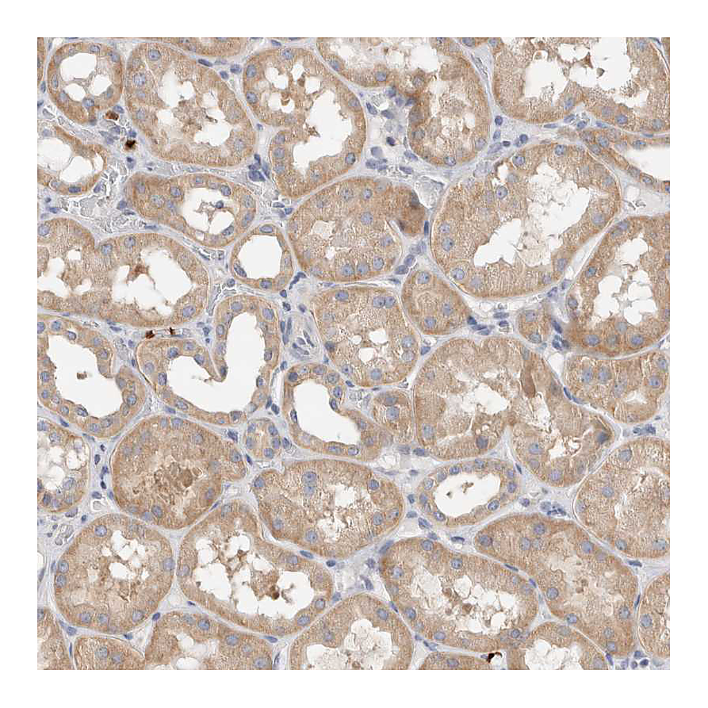 Atlas Antibodies Anti-NXT2 Antibody