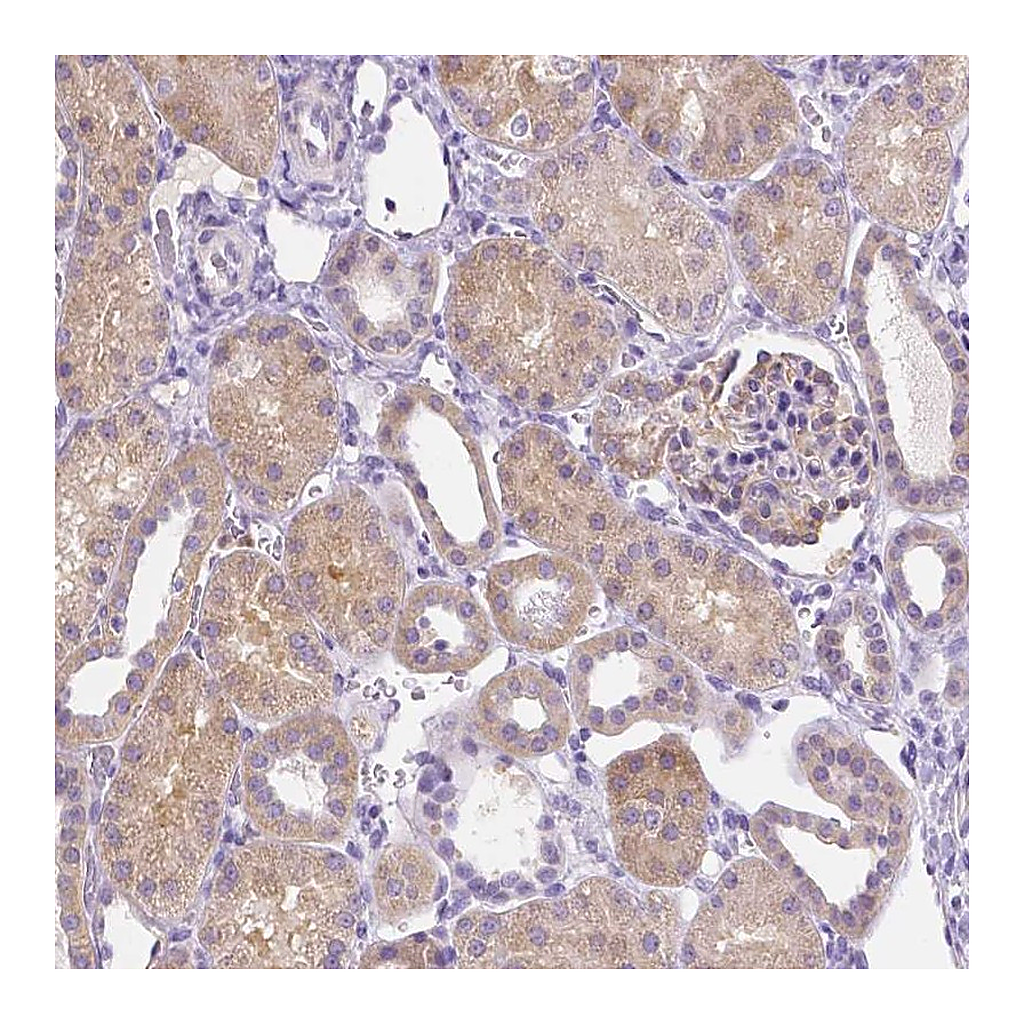 Atlas Antibodies Anti-NXPH2 Antibody