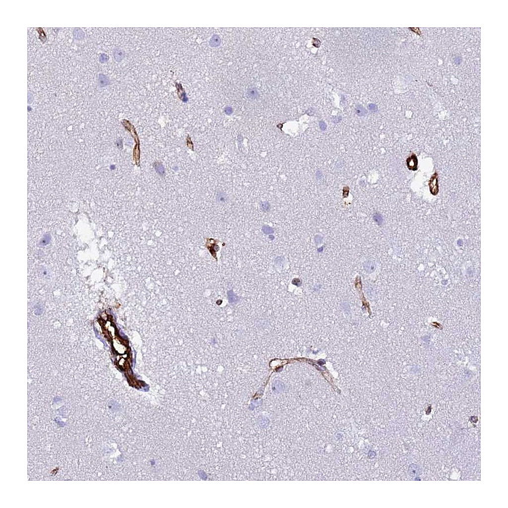 Atlas Antibodies Anti-NXPH1 Antibody