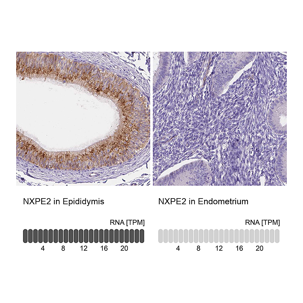 Atlas Antibodies Anti-NXPE2 Antibody