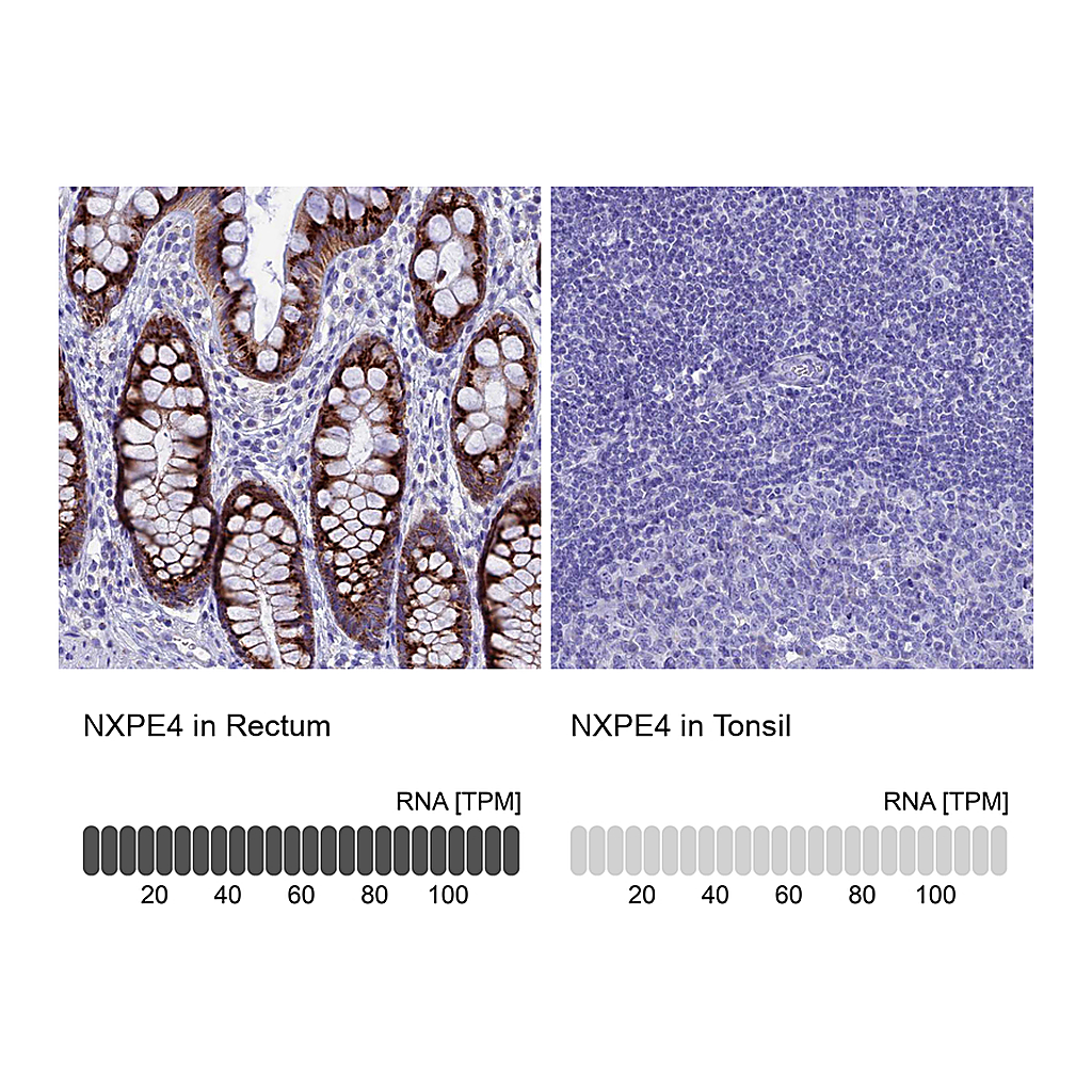 Atlas Antibodies Anti-NXPE4 Antibody