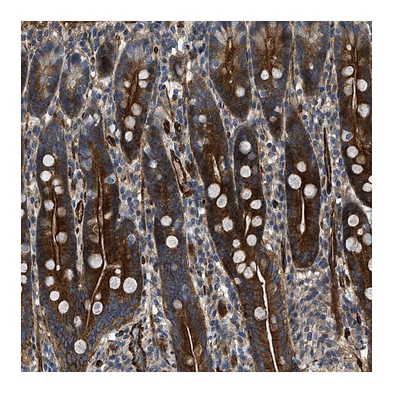 Atlas Antibodies Anti-NYNRIN Antibody