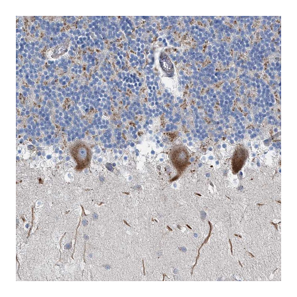 Atlas Antibodies Anti-NYAP1 Antibody
