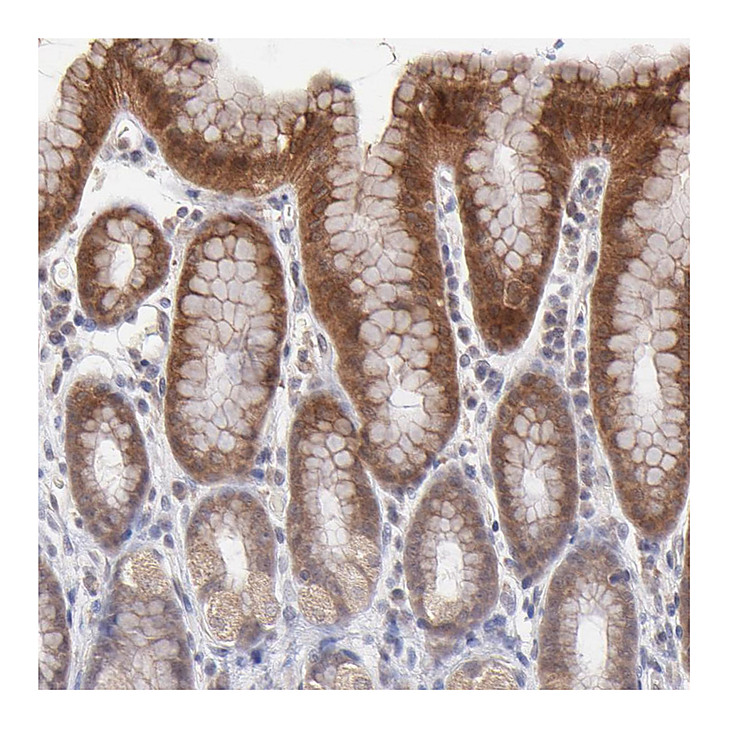 Atlas Antibodies Anti-OAS1 Antibody